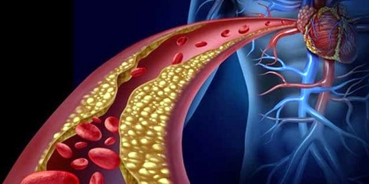 Disadvantages of high cholesterol