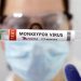 Alert Monkeypox has arrived in Pakistan