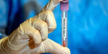 No cases of Hantavirus have been reported yet, says Turkish Health Ministry