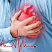 The silent killer's knock, what does it feel like before a heart attack