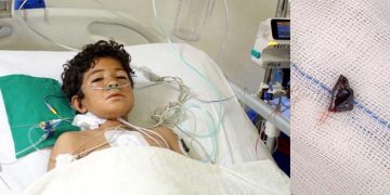 12-year-old boy from Balochistan discharged after complex surgery to remove a bullet lodged in his heart.