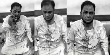 Significant development in the case regarding the assault on University of Karachi Professor Arif Saqi a settlement has been reached following an apology from the accused.