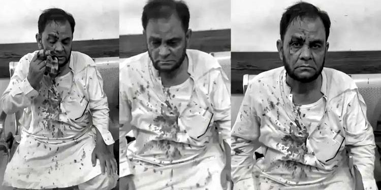 Significant development in the case regarding the assault on University of Karachi Professor Arif Saqi a settlement has been reached following an apology from the accused.