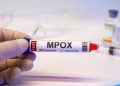18-month-old child dies of monkeypox in Karachi; death toll in Sindh reaches 12.