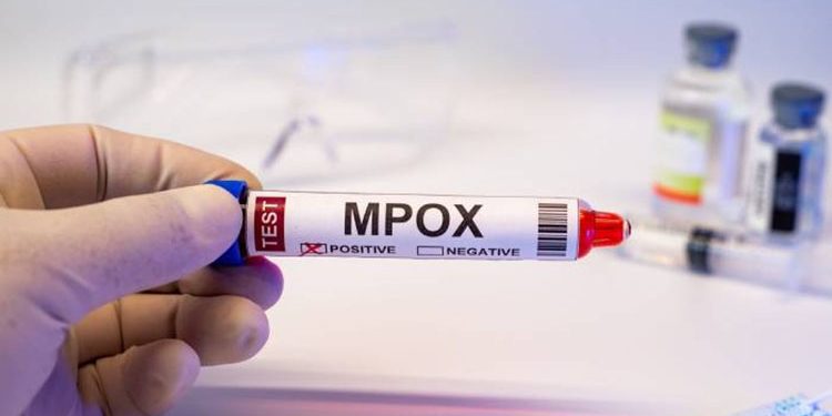 18-month-old child dies of monkeypox in Karachi; death toll in Sindh reaches 12.