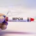 18-month-old child dies of monkeypox in Karachi; death toll in Sindh reaches 12.